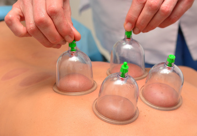 Deep Tissue Cupping Massage