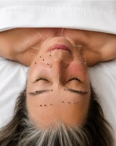Skin Reset Acupuncture Ritual